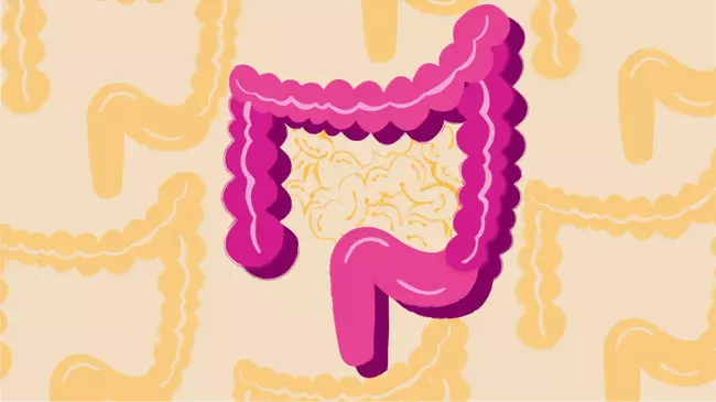 La genetica della malattia di Crohn