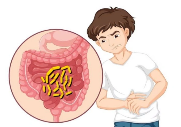 Disturbi digestivi genetici